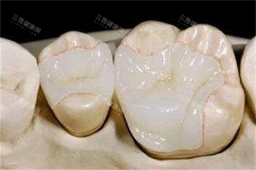 牙齿修复改善照片图