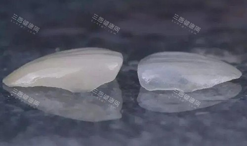 瓷贴面修复对比
