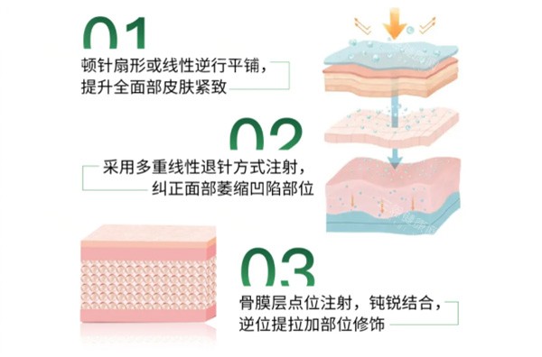 艾维岚注射皮肤层级图片 艾维岚注射皮肤层级图片