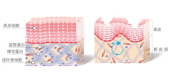 艾维岚填充皮肤示意图 艾维岚填充皮肤示意图