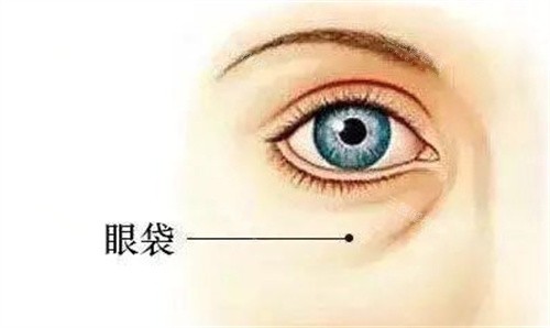 眼袋