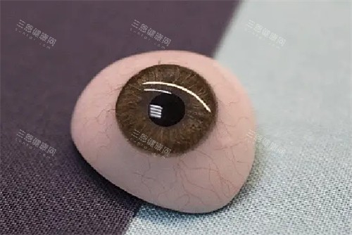 义眼图