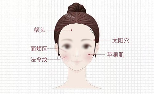 注射必看!瑞士五点提升针鼓包≠失败!溶胀期护理+硬块处理全攻略