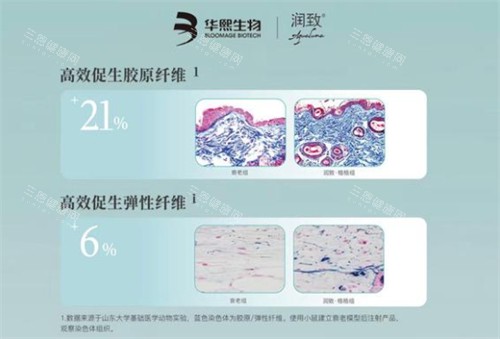 润致格格针咋样