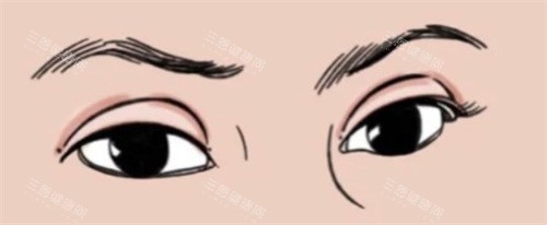 株洲整形机构推荐：星薇美/衡阳晶肤/河西华美做整形好又棒