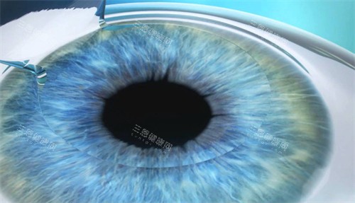 爱尔眼科和正规医院相比哪个更好？从设备水平/诊疗模式/服务细节等方面帮你对比剖析找到选择！