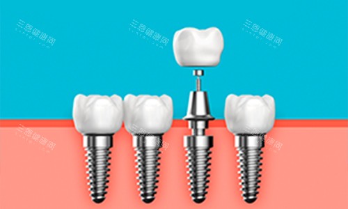 北京永康宾泰口腔收费合理吗？为啥便宜？真实用户评价和看牙流程分享！