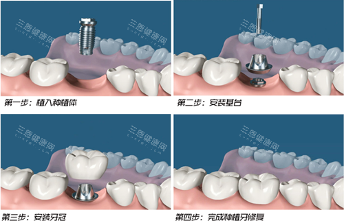 北京嘉洁口腔服务好吗？从预约到复诊全流程体验，附价目表和真实用户评价！