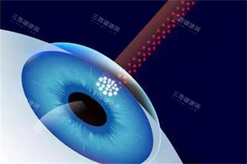 南昌近视眼手术医院哪家好?南昌激光矫正必看!洪城爱尔/华厦/普瑞三家口碑前三强对比
