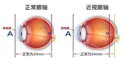 2025长沙眼科医院价格表查询：全飞秒15800元起，30种眼科手术收费明细一览
