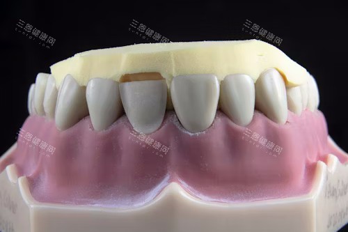 苏州高新区牙科诊所哪家好？牙博士口腔、圣爱口腔、美奥口腔是高新区正规口腔医院