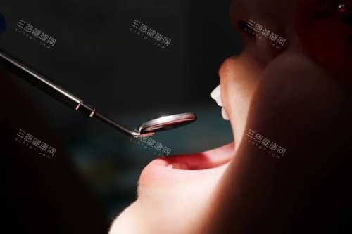 牙齿检查展示图