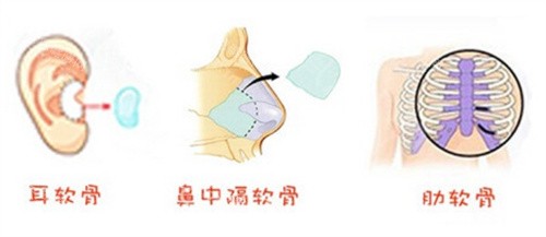 自体组织