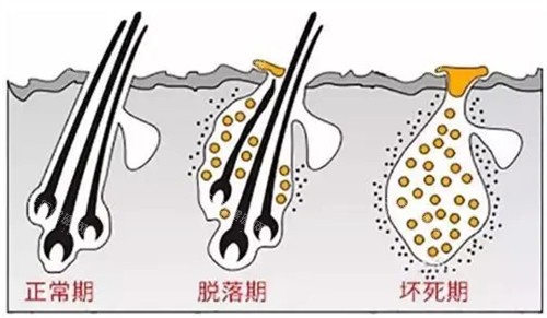 头发生长周期图解