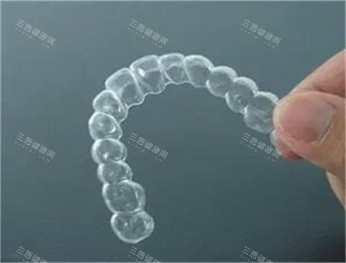 隐形牙齿矫正器示意图