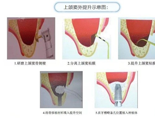 深圳正恩口腔就诊全攻略：预约挂号流程+地址详解，附医院简介！