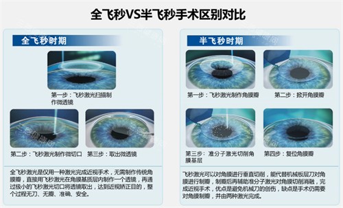 全飞秒在国外是禁止的吗？并没有哦！已过得美国FDA/欧洲CE/日本厚生劳动省以及我国CFDA认证