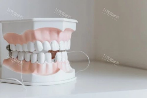 残缺的牙齿展示