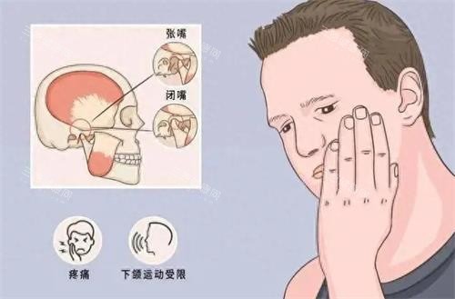 汕口口腔医院咬合不对的状态