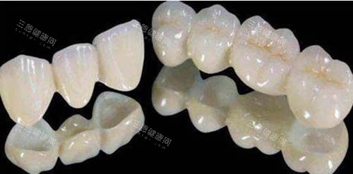 全瓷牙套照片