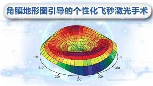 个性化飞秒激光手术