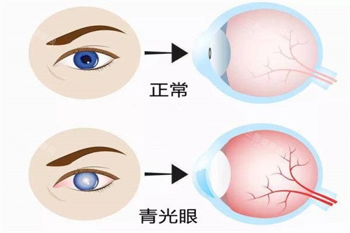 湘雅眼科特靠谱三个医生:夏晓波领衔""三高""眼病天团！白内障/青光眼/视网膜病变疑难病例全攻略