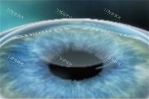 新疆乌鲁木齐美尼康眼科价格表：半飞秒16000元起，全飞秒18000元起，晶体植入32000元起！