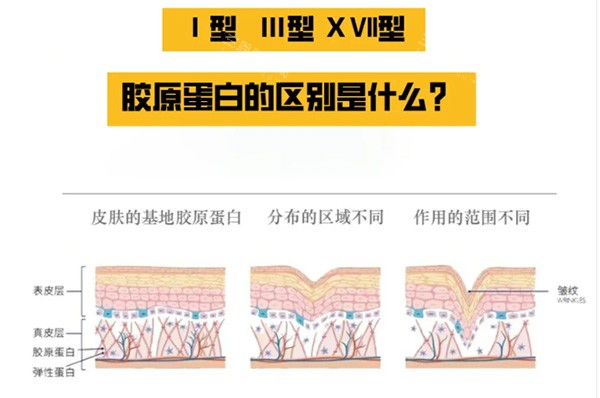 胶原蛋白一型和三型对比区别
