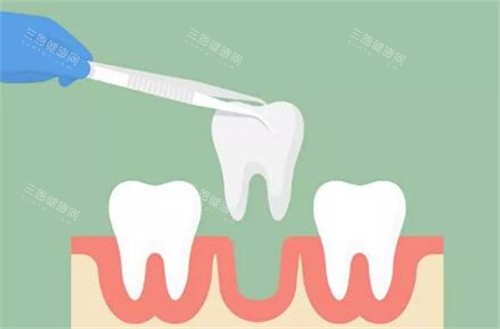 郑州艾薇口腔好不好？显微根管治疗实例实拍图，口碑揭秘下！