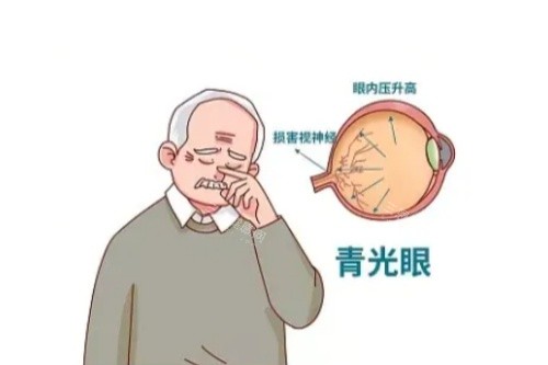 郑州第二人民医院眼科收费价格表更新！近视矫正/青光眼治疗要准备多少预算？一文说清楚