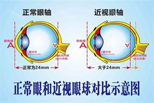 2024~2025杭州浙大二院眼科医院收费一览表：全飞秒1.8w+/白内障手术5k+/青光眼手术3k+