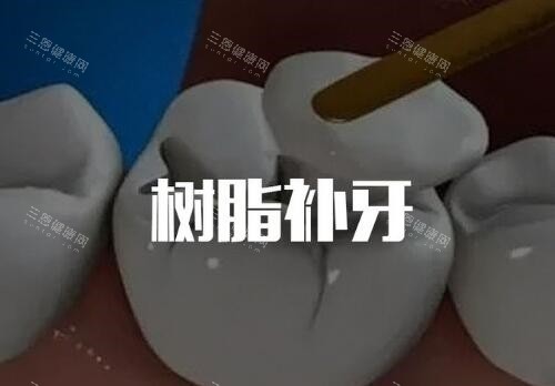 哦吼~桂林医院牙科收费价目表2025版：内含补牙/拔牙/镶牙/假牙义齿/种植牙/儿牙项目价格！