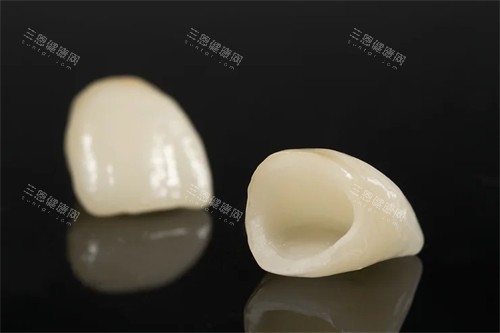 两颗全瓷牙牙冠实物展示图 两颗全瓷牙牙冠实物展示图