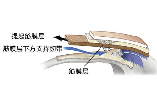 SMAS筋膜层图片展示