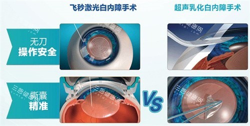 徐州市第一人民医院眼科预约挂号，公众号/官网/电话全渠道，手把手教你抢号