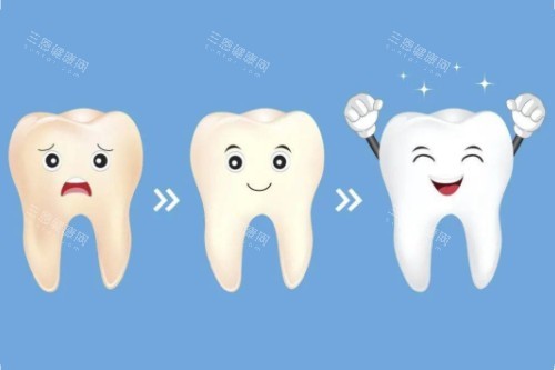 牙齿美白顺序图