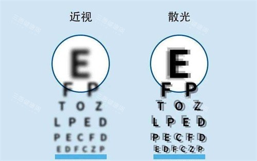 近视眼镜和散光的区别