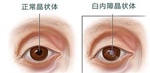 新疆自治区医院眼科电话,24小时预约询问热线,预约挂号+在线询问+获取价格