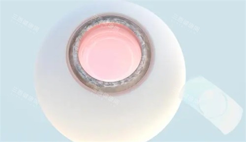 新疆自治区医院眼科收费价格:半飞秒/全飞秒/​白内障/角膜塑形镜等价格