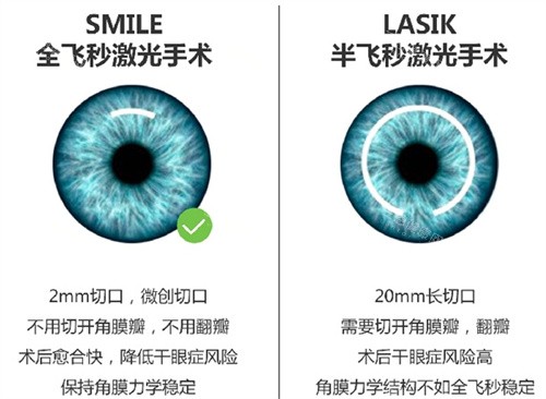 南昌大学附属眼科医院2025价格查询，屈光矫正/白内障/眼底病/角膜病/儿童眼科等价格