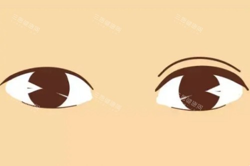 双眼皮、单眼皮卡通对比图