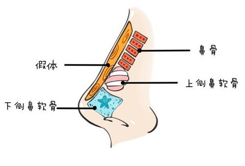 彭炜峰做鼻子怎么样？从背景、技术优势、评价、价格等解析