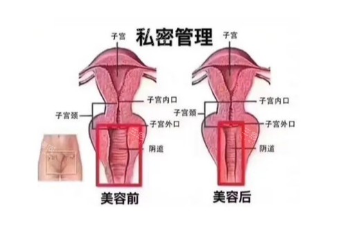私密管理前后对比图