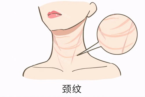 南京面部提升多少钱？埋线提升1200起/筋膜悬吊5498起/光电提升2974起