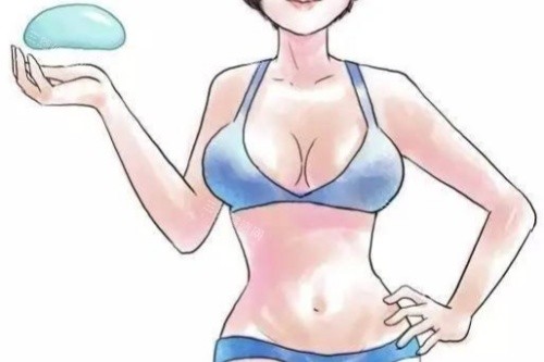 南京黄名斗假体丰胸卡通图