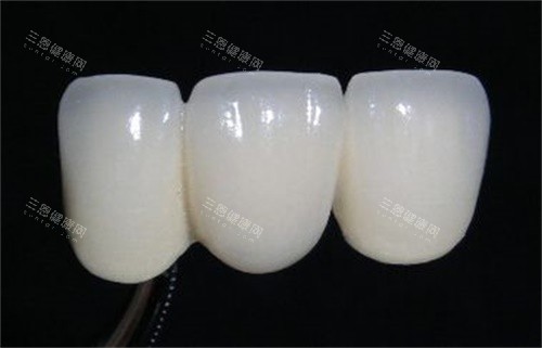 阎良做牙冠去哪？王文利/雅洁/佳乐/齐贝等4家，技术棒成果赞