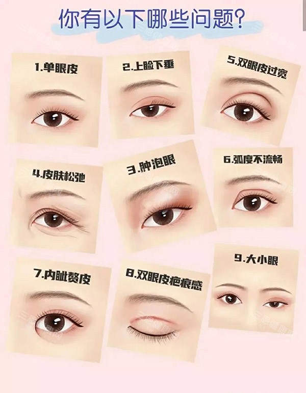保定做双眼皮哪家好？保定这3家华美/蓝山/珍润做过的人都说好