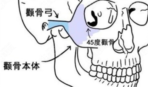 颧骨颧弓所在位置