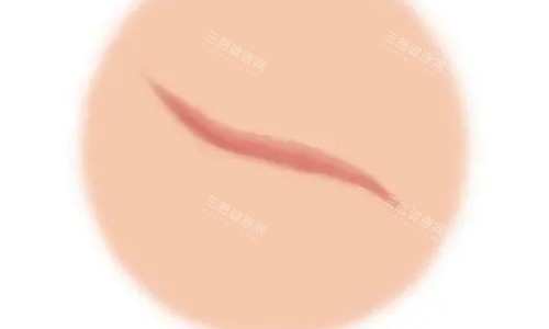 晋永杰VS刘加勇祛疤哪个强？技术/价格/口碑深度对比，选对医生不踩坑！