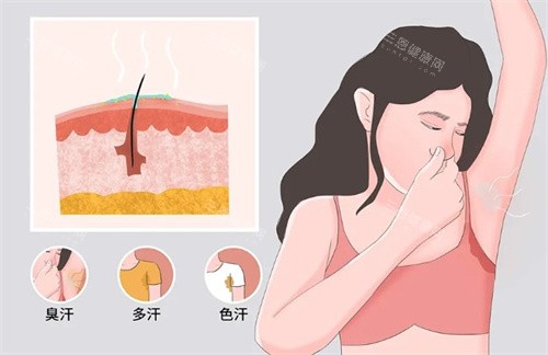 清新微波腋臭手术多少钱？总体价格范围大致在 5000元至30000元 之间